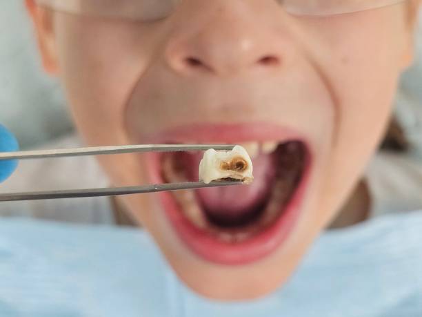 Best Broken Tooth Emergency  in Grand Island, NE